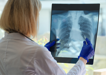 Allergic Reactions - Air Con Cleaning - Purify Air