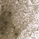 Aspergillus mould in air conditioners